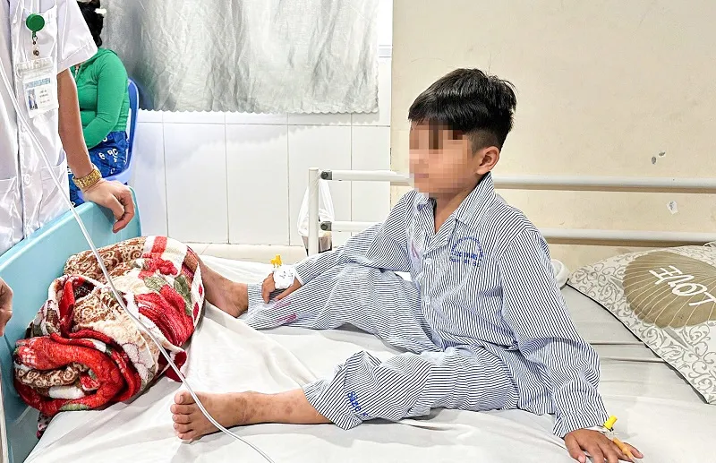 Bé trai được phẫu thuật thành công sau khi nuốt phải cục nam châm dẫn đến thủng ruột.