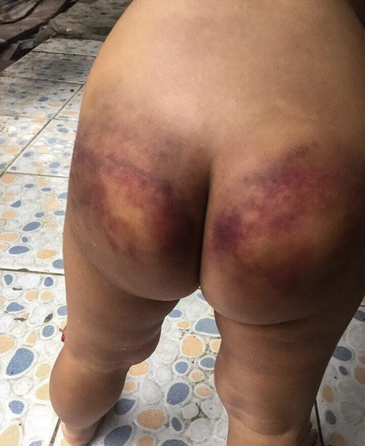 Bé trai 3 tuổi ở Bình Dương nghi bị mẹ ruột và cha dượng bạo hành ảnh 1