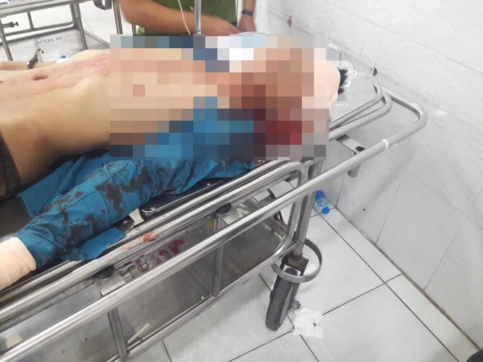 Bắt nhóm đối tượng truy sát nhóm thanh niên vì ghen... nhầm ảnh 2