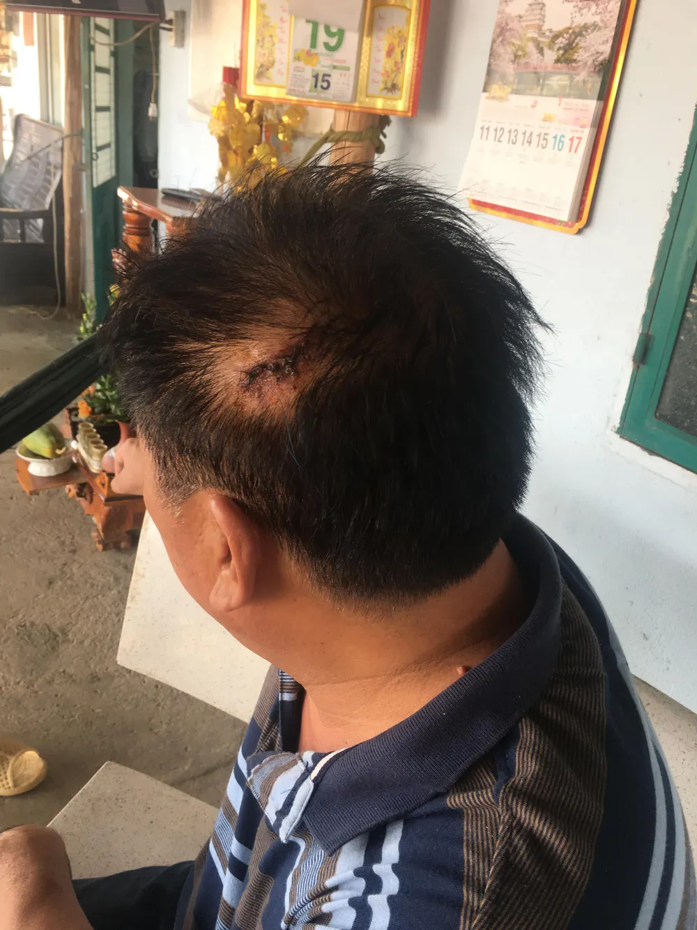 Một giám đốc bị “giang hồ” chém trọng thương ảnh 3