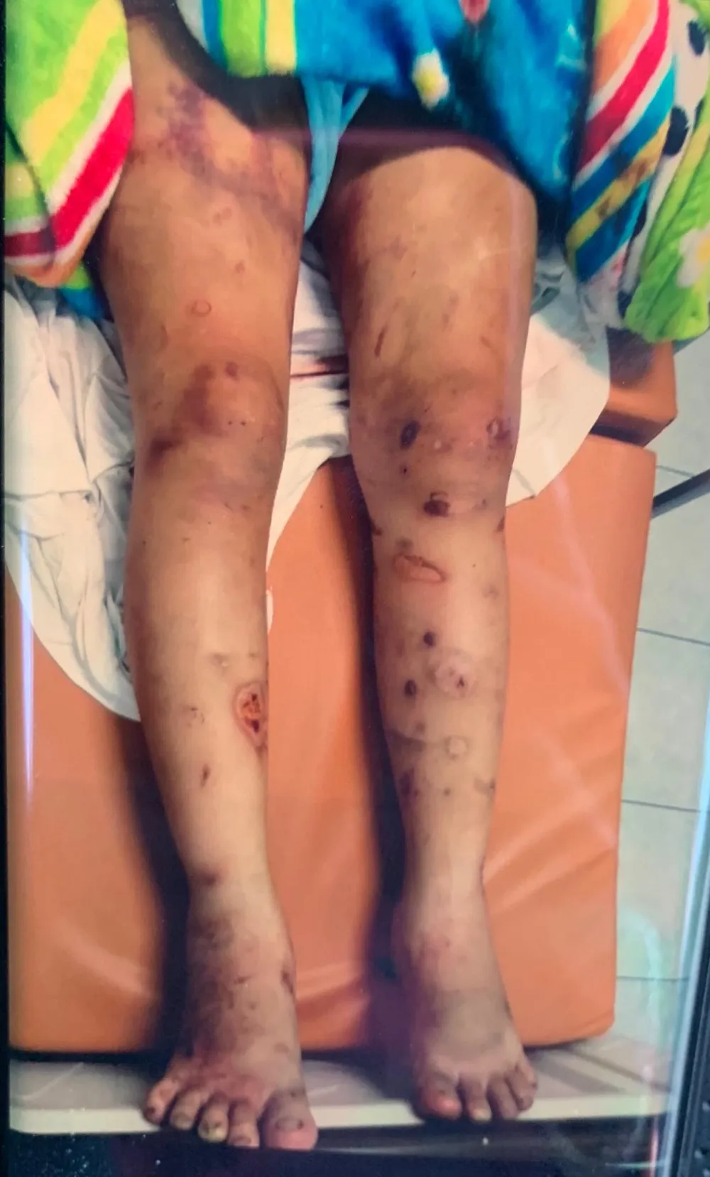 Bắt kẻ chủ mưu bắt cóc, tra tấn khiến thai phụ 18 tuổi sẩy thai ảnh 2