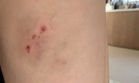 Nhóm “giang hồ” dùng súng, mã tấu truy sát khiến 2 người bị thương ở quán cà phê ảnh 2