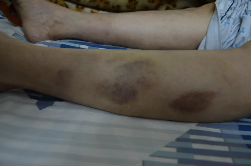  Nhóm côn đồ đập phá nhà dân, đánh 2 người phụ nữ nhập viện cấp cứu ảnh 2