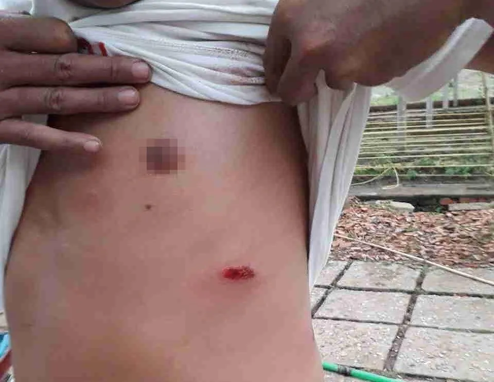 Cả gia đình bị nhóm “giang hồ” dùng súng, hung khí đe dọa ảnh 4