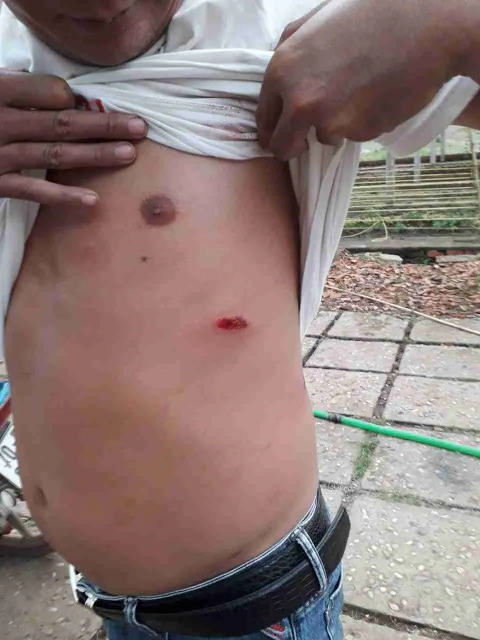 Khởi tố hình sự vụ cả gia đình bị nhóm “giang hồ” dùng súng, hung khí đe dọa ảnh 4