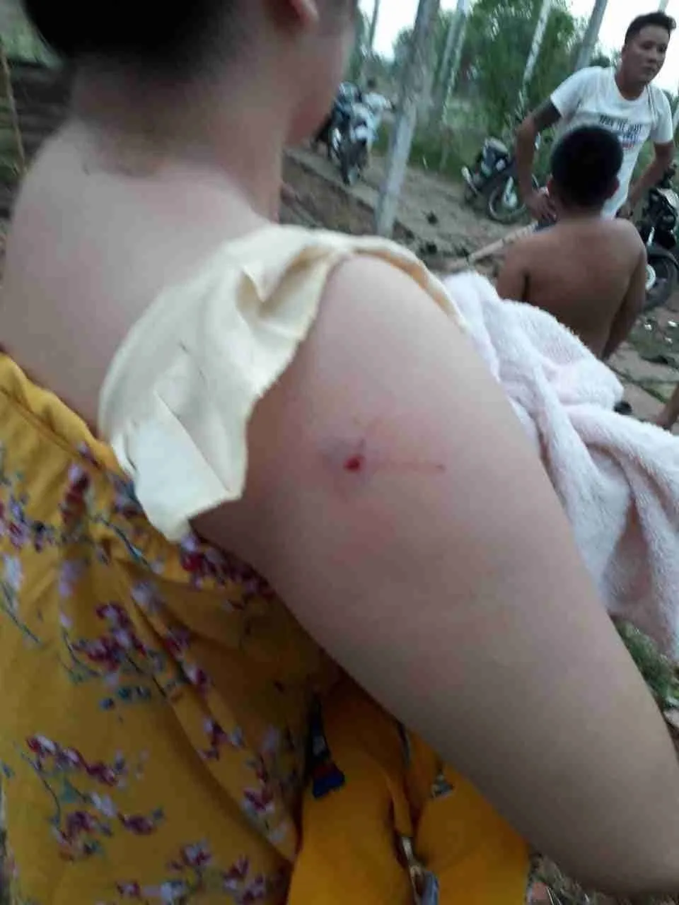 Khởi tố hình sự vụ cả gia đình bị nhóm “giang hồ” dùng súng, hung khí đe dọa ảnh 5