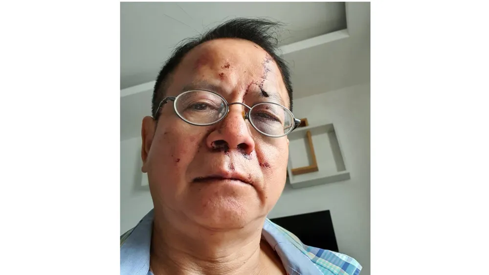 Ông Bân bị nhóm thanh niên đánh trọng thương trong quán karaoke