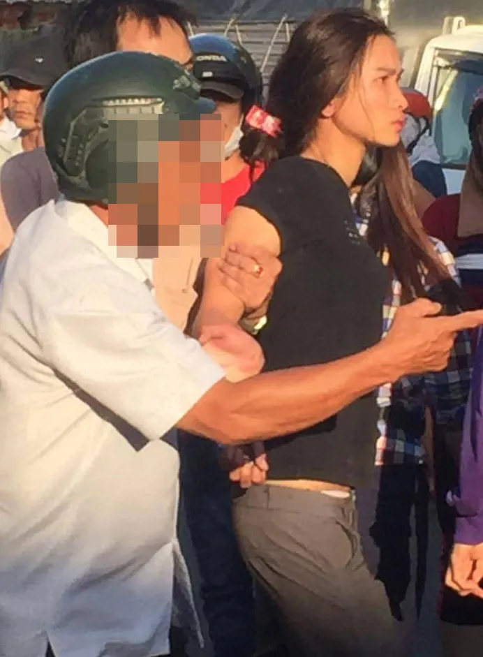 Khởi tố vụ án cháu bé bị dì ruột châm xăng đốt bỏng nặng hơn 50% ảnh 1