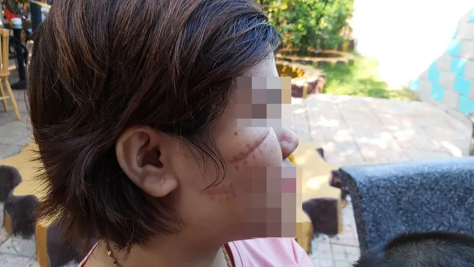 Bắt nhóm côn đồ rạch mặt dã man nữ công nhân trước cổng công ty  ảnh 2