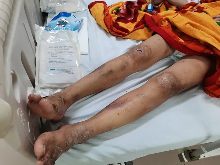 Khởi tố thêm 3 đối tượng trong vụ nhân viên quán cà phê bị đánh nguy kịch vì không chịu kích dục ảnh 2