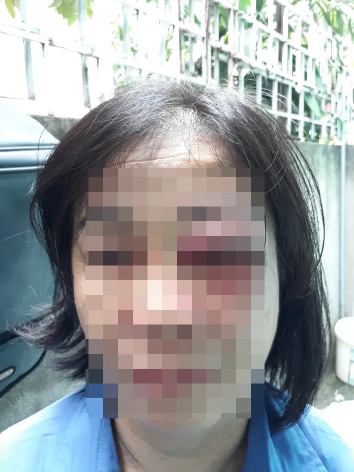 Người đàn ông đánh nữ tiếp viên xe buýt sưng mắt vì bị nhắc nhở mở nhỏ nhạc ảnh 1