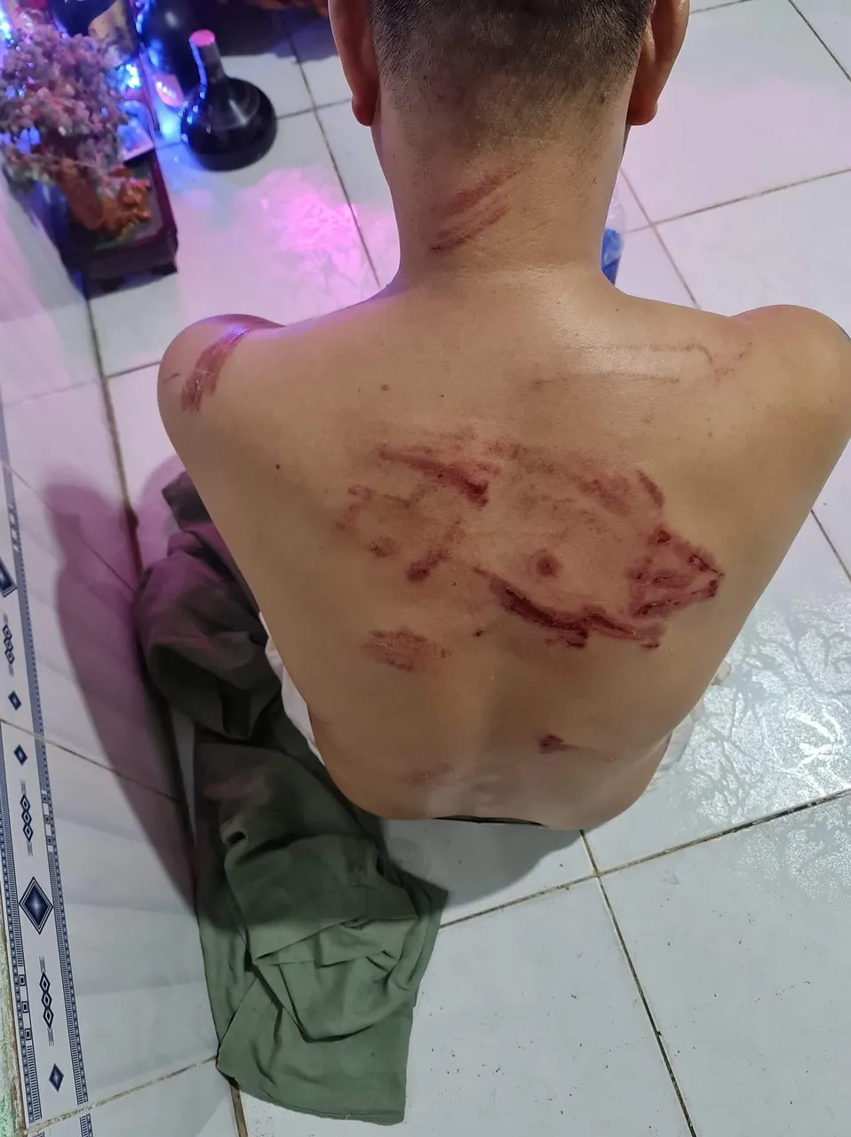 Nhóm “giang hồ” dùng hung khí xông vào nhà dân đánh người ảnh 4