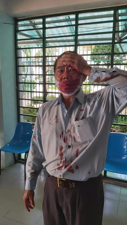 Sau xét thi đua, phó trưởng phòng cơ sở cai nghiện bị nhiều nhân viên đánh ảnh 1