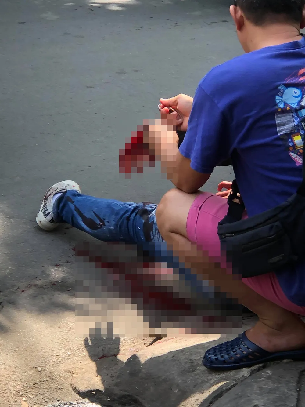 Thanh niên bị côn đồ truy đuổi, chém gần đứt lìa tay ở quận 7 ảnh 1