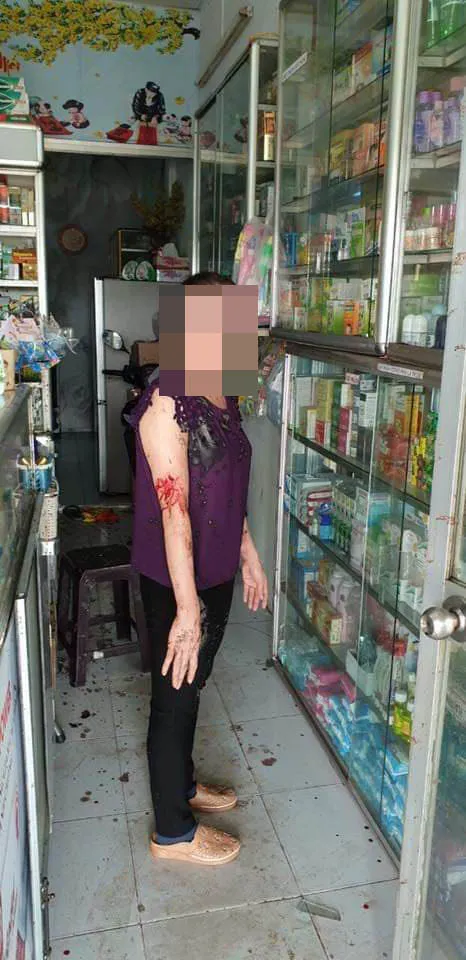 Khởi tố 2 vợ chồng thuê “giang hồ” tạt chất bẩn, mắm tôm vào tiệm thuốc tây ở quận 8 ảnh 3