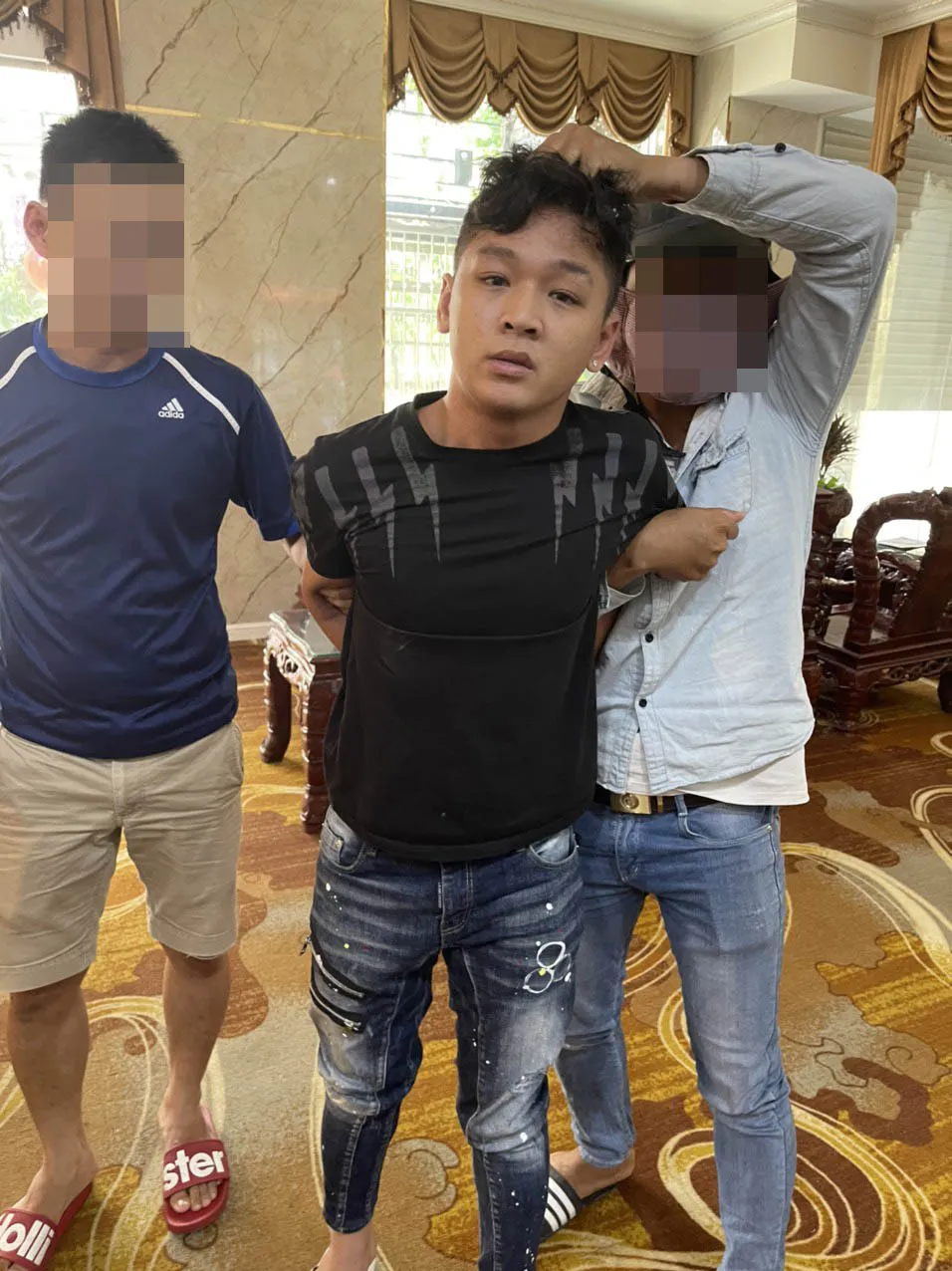 Thanh niên giật túi xách khiến cô gái ngã chấn thương sọ não ảnh 2