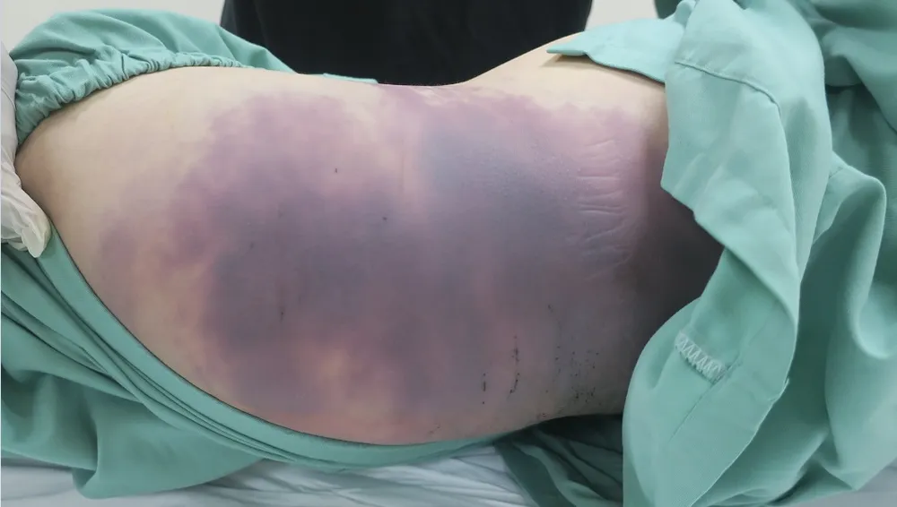 Mẹ ruột bé gái 8 tuổi bị bạo hành tử vong gửi đơn yêu cầu khởi tố chồng cũ ảnh 1