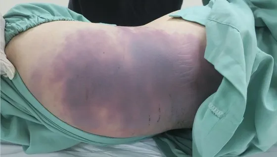 Vụ bạo hành bé gái 8 tuổi dẫn đến tử vong: Luật sư kiến nghị đổi tội danh người cha sang tội "Giết người" ảnh 3