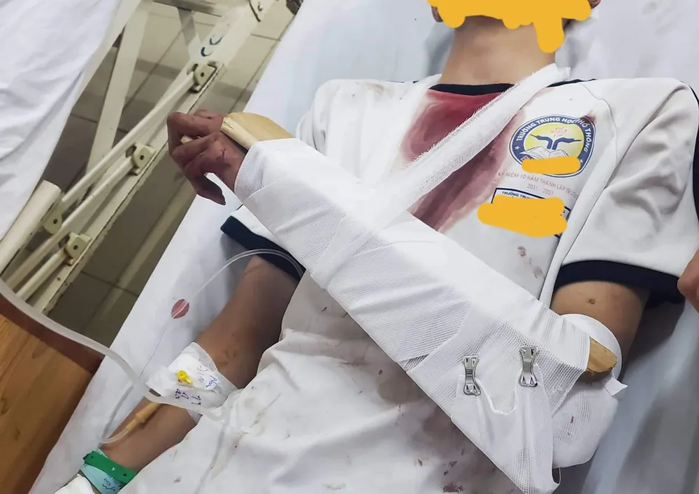 Nam sinh bị nhóm côn đồ đuổi chém trọng thương vì mâu thuẫn trên mạng ảnh 1