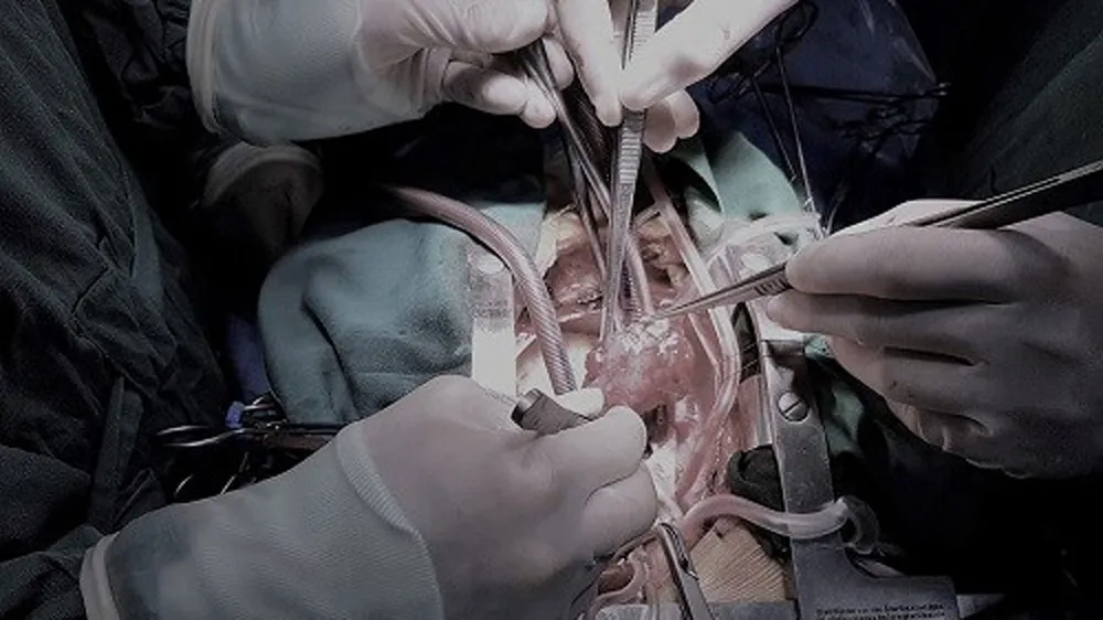 Các bác sỹ đang tiến hành phẫu thuật cho bệnh nhân Xuân. Ảnh: H.Y.