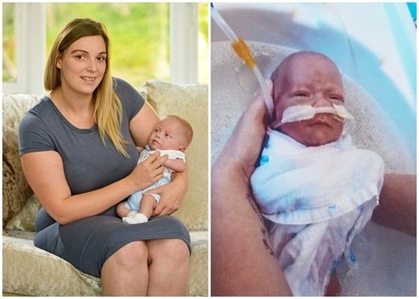 最細早產嬰兒　出世時輕過一罐汽水