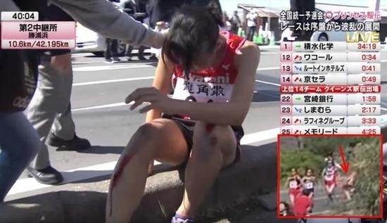 骨折女選手飯田憐。