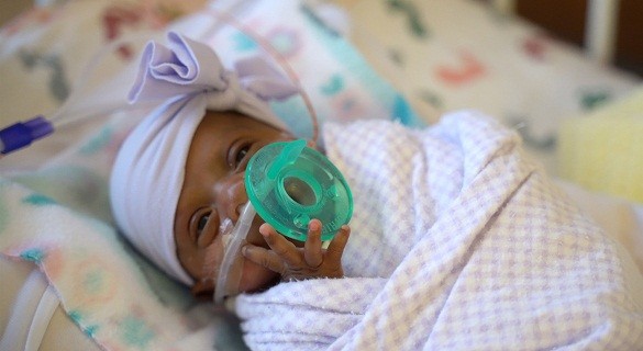 “世界最小存活嬰兒”僅重 245 克