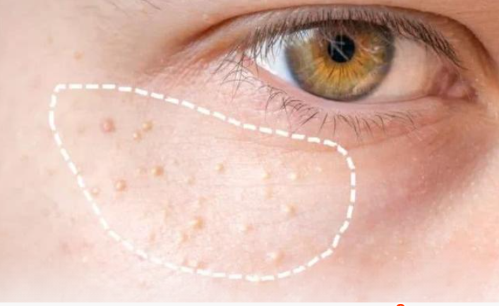 （示意圖源：互聯網） 