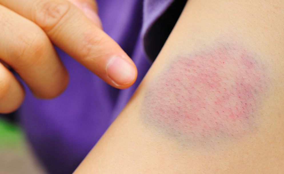 （示意圖源：互聯網） 