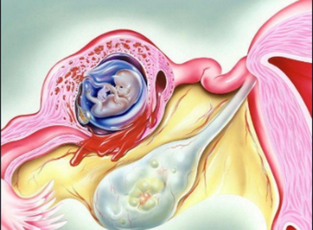 （圖源：互聯網） 