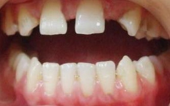 （示意圖源：互聯網） 