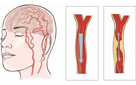 （示意圖：互聯網）