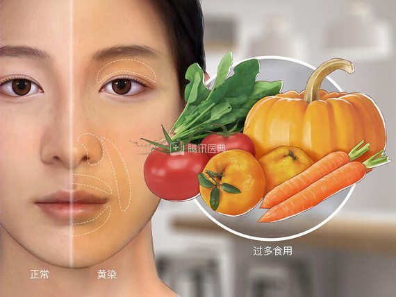 （示意圖源：互聯網）