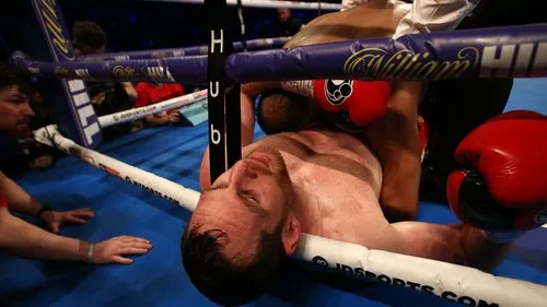 Quyền Anh: Cắn đối thủ đồng hương, võ sĩ Anh sẽ bị cấm thi đấu ảnh 2