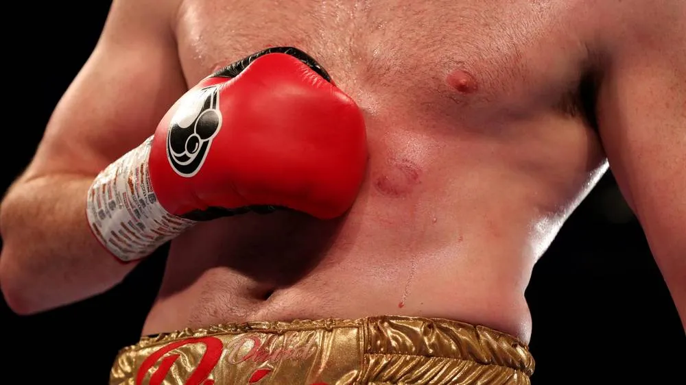 Quyền Anh: Cắn đối thủ đồng hương, võ sĩ Anh sẽ bị cấm thi đấu ảnh 4