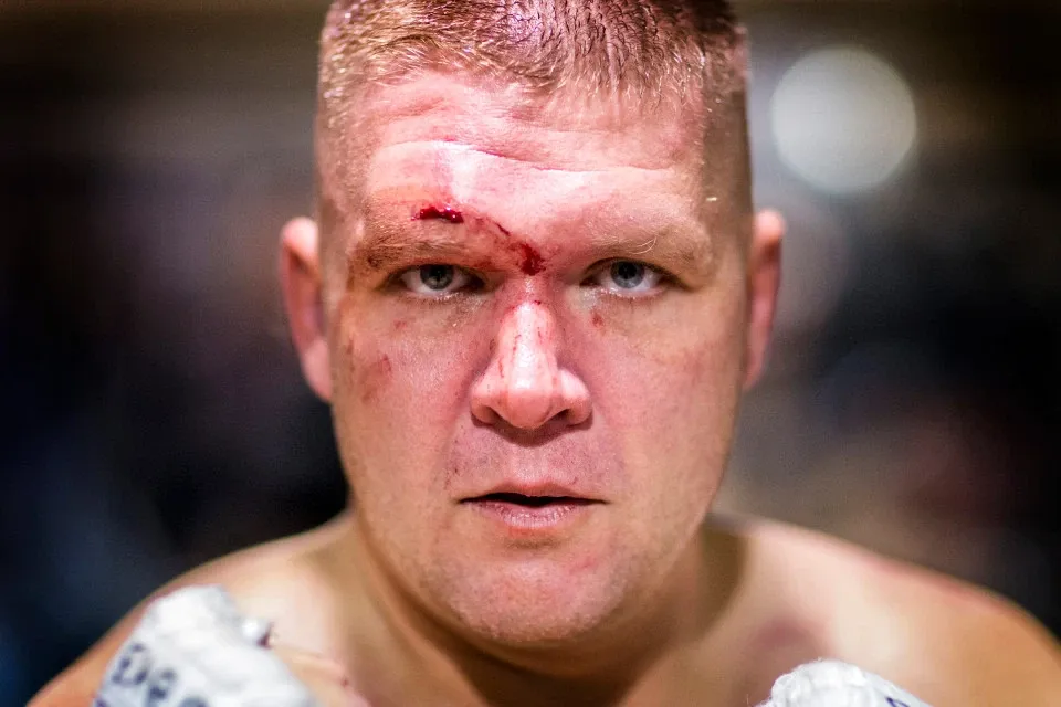 Đấu quyền không găng an toàn hơn… MMA và quyền Anh? ảnh 6