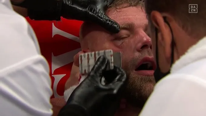 Canelo Alvarez: Đấm vỡ xương gò má Billy Joe Saunders, khiến đối thủ không thể ứng chiến sau hiệp 8 ảnh 6