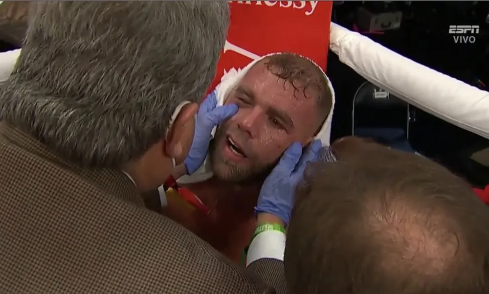 Canelo Alvarez: Đấm vỡ xương gò má Billy Joe Saunders, khiến đối thủ không thể ứng chiến sau hiệp 8 ảnh 5