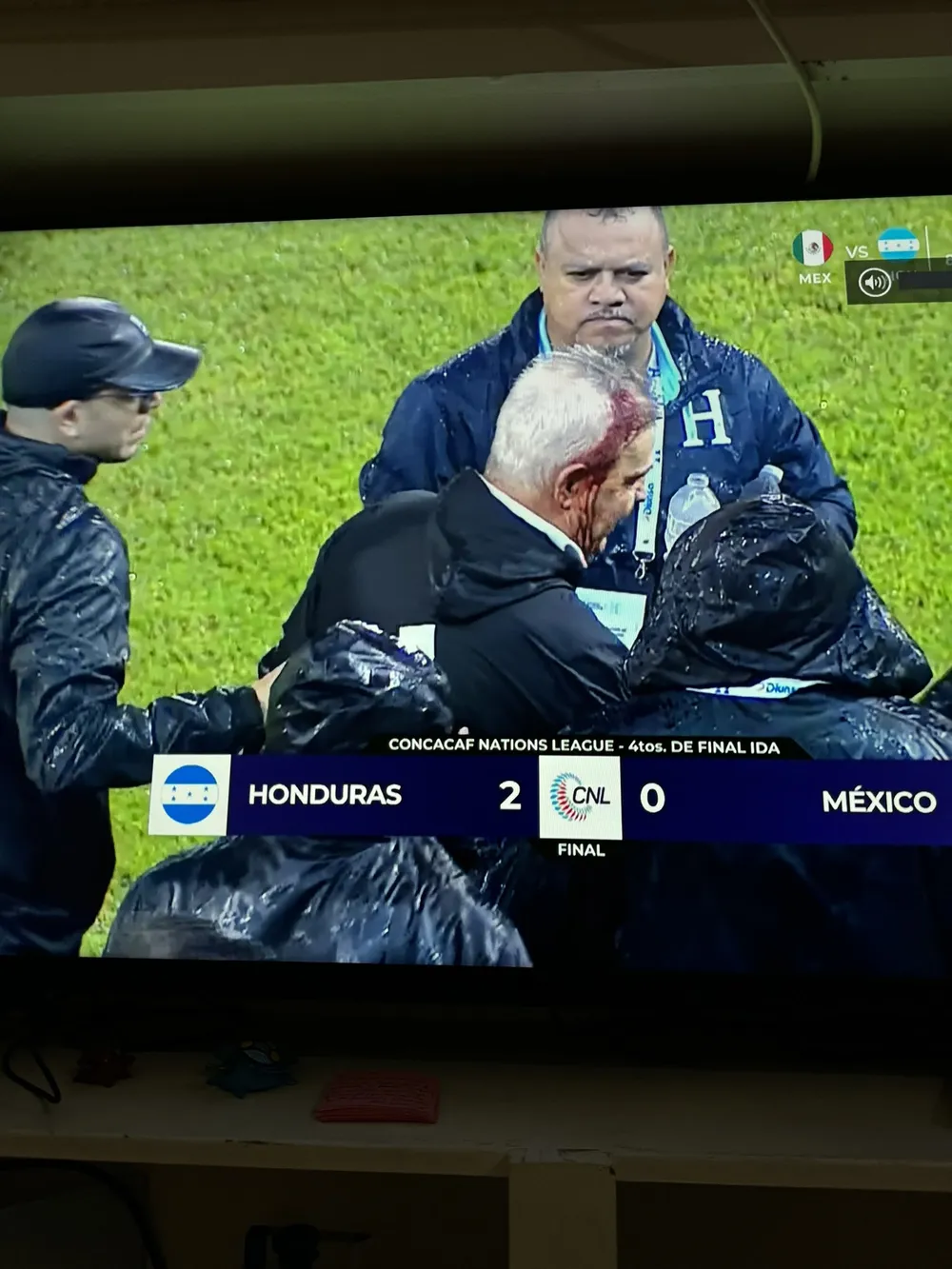Hình ảnh ông Aguirre chảy máu đầu chụp qua màn hình ti vi