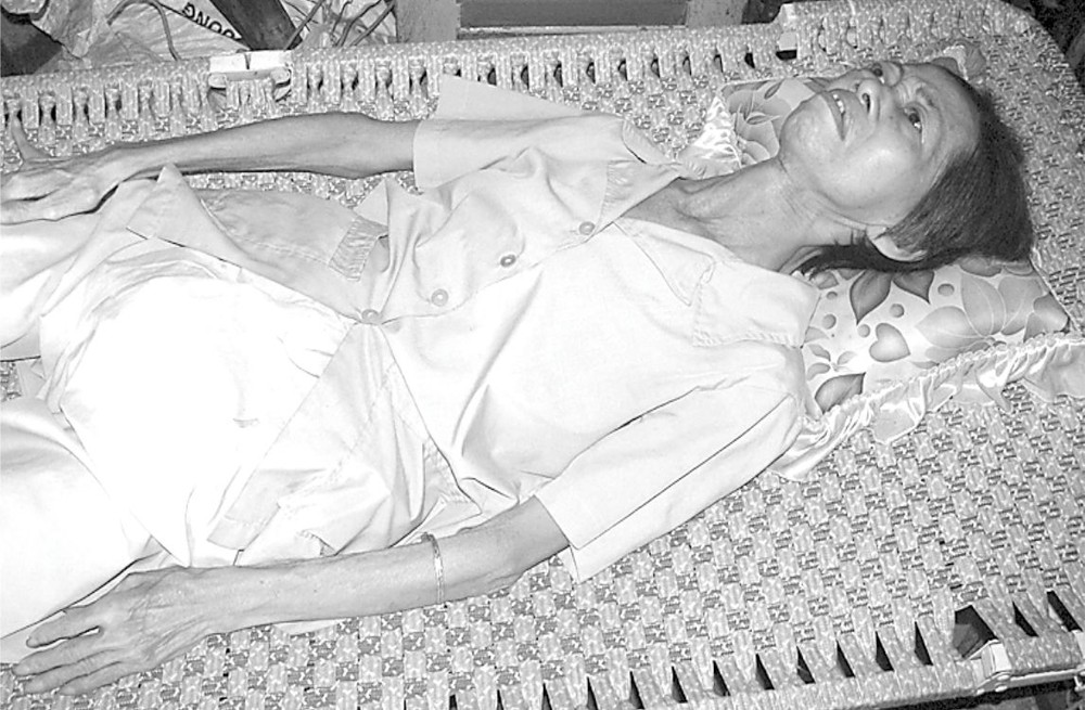 黃燕玲瘦骨如柴，一直躺在長椅上。