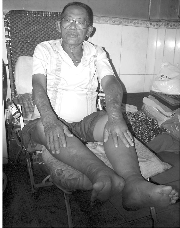 請向腎衰竭病人伸援手