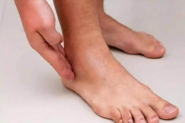 别忽视双脚信号！这4种表现，可能暗藏疾病