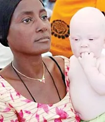 Tanzania: Kinh hoàng nạn “săn” người bạch tạng