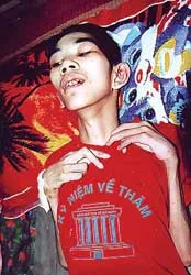 Ốm liệt giường trong gia cảnh nghèo