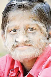 Người sói Ấn Độ