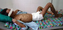 Nỗi niềm bệnh nhân AIDS ảnh 2