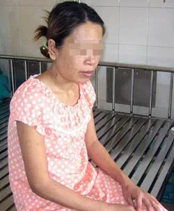 Nỗi niềm bệnh nhân AIDS
