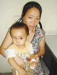 Bé Ngọc Toàn với khối u nguyên bào võng mạc