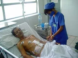 Cắt khối u gan bằng sóng siêu âm