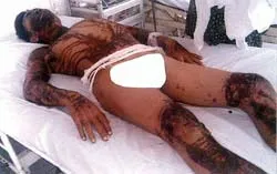 Một kẻ liều, hai gia đình bất hạnh